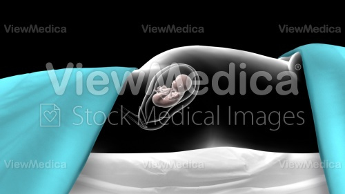 ViewMedica