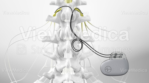 ViewMedica