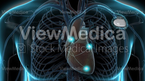 ViewMedica