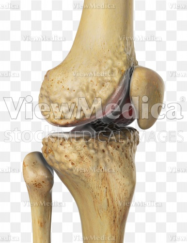 ViewMedica