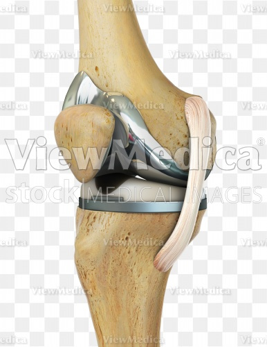 ViewMedica