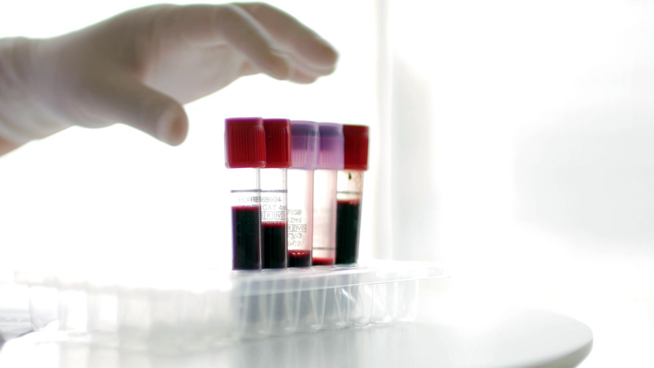 Allergy Blood Test