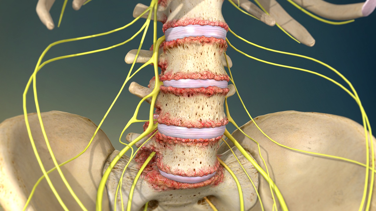 Back And Neck Pain Johns Hopkins Medicine