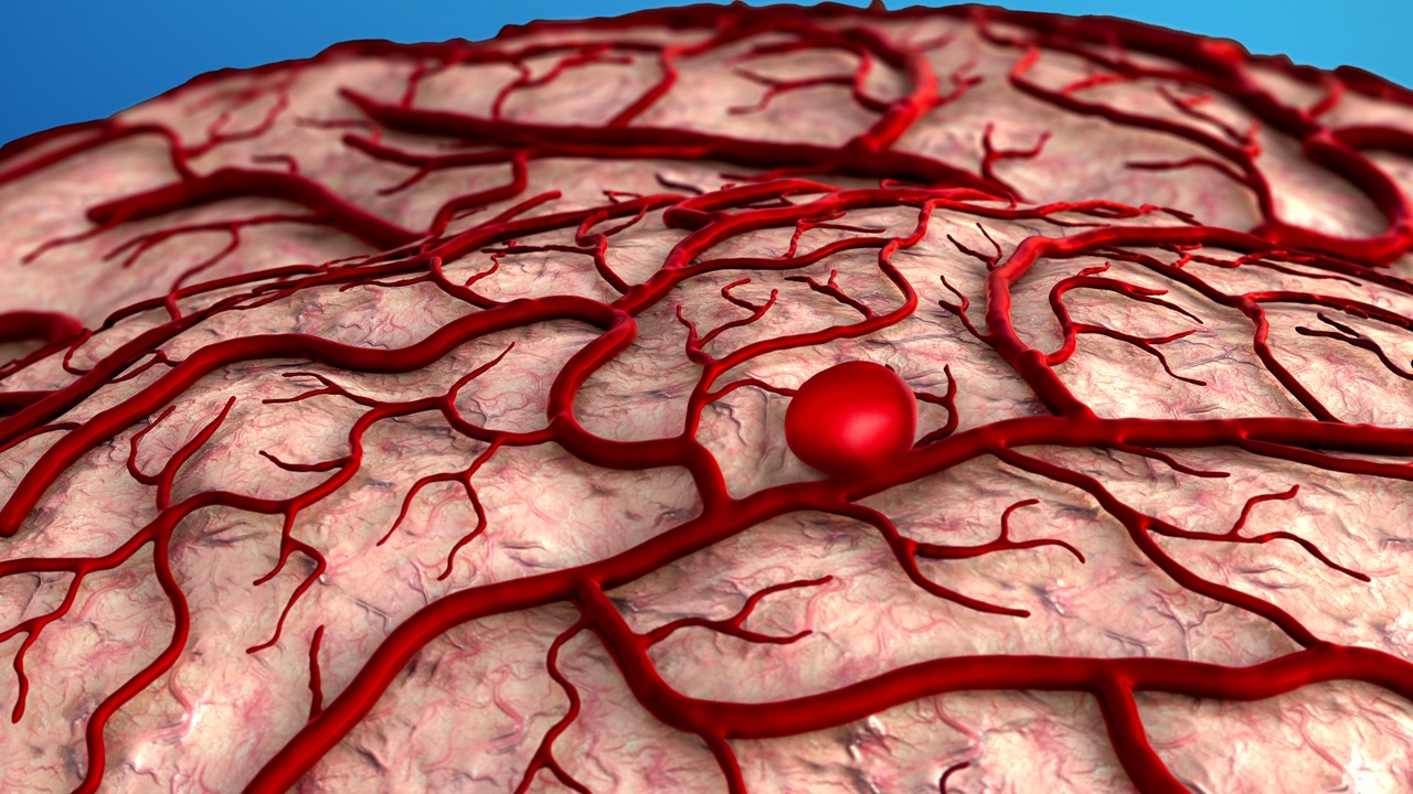 The NeuroMedical Center | Patient Education Library | Brain Aneurysm